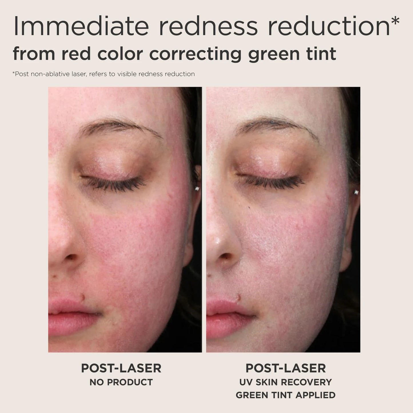 Green Color-Correcting Sunscreen SPF 50 โ Neutralizes Redness & Evens Skin Tone