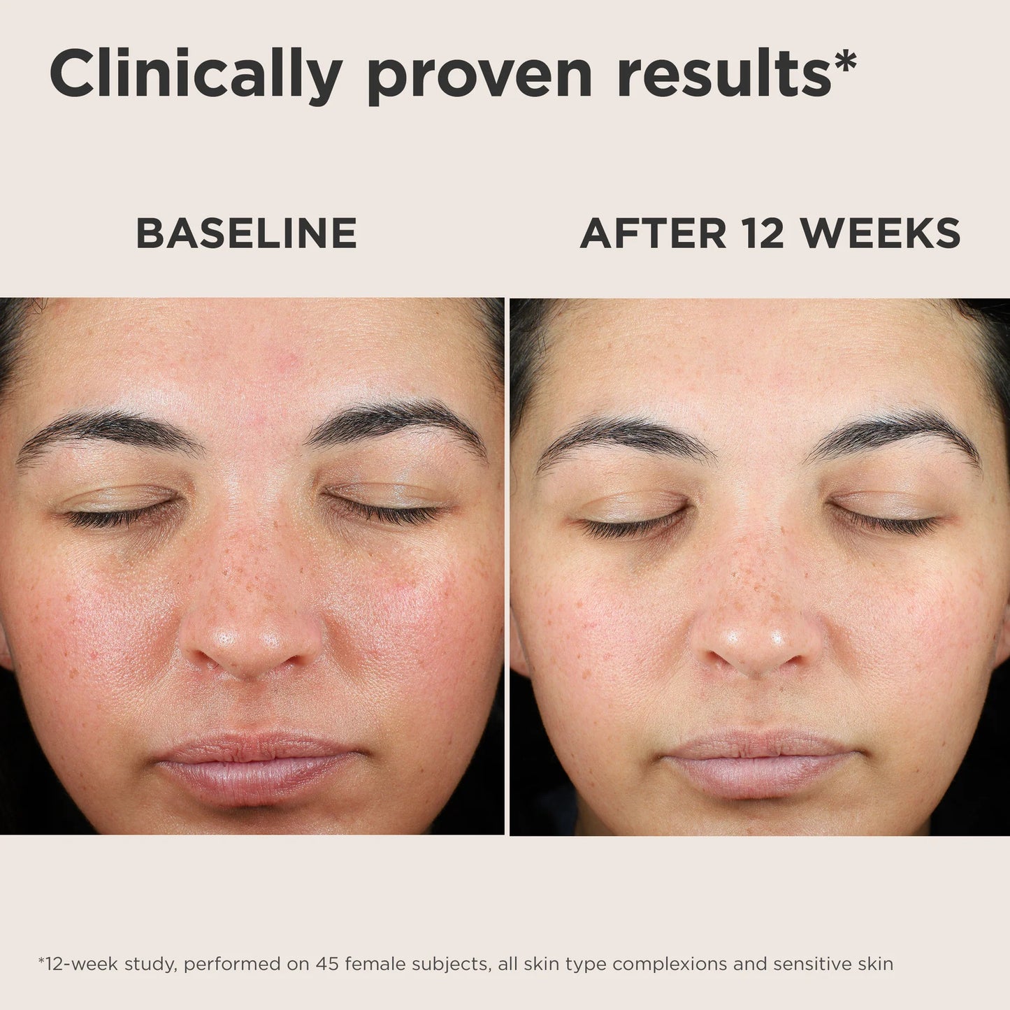 Green Color-Correcting Sunscreen SPF 50 โ Neutralizes Redness & Evens Skin Tone