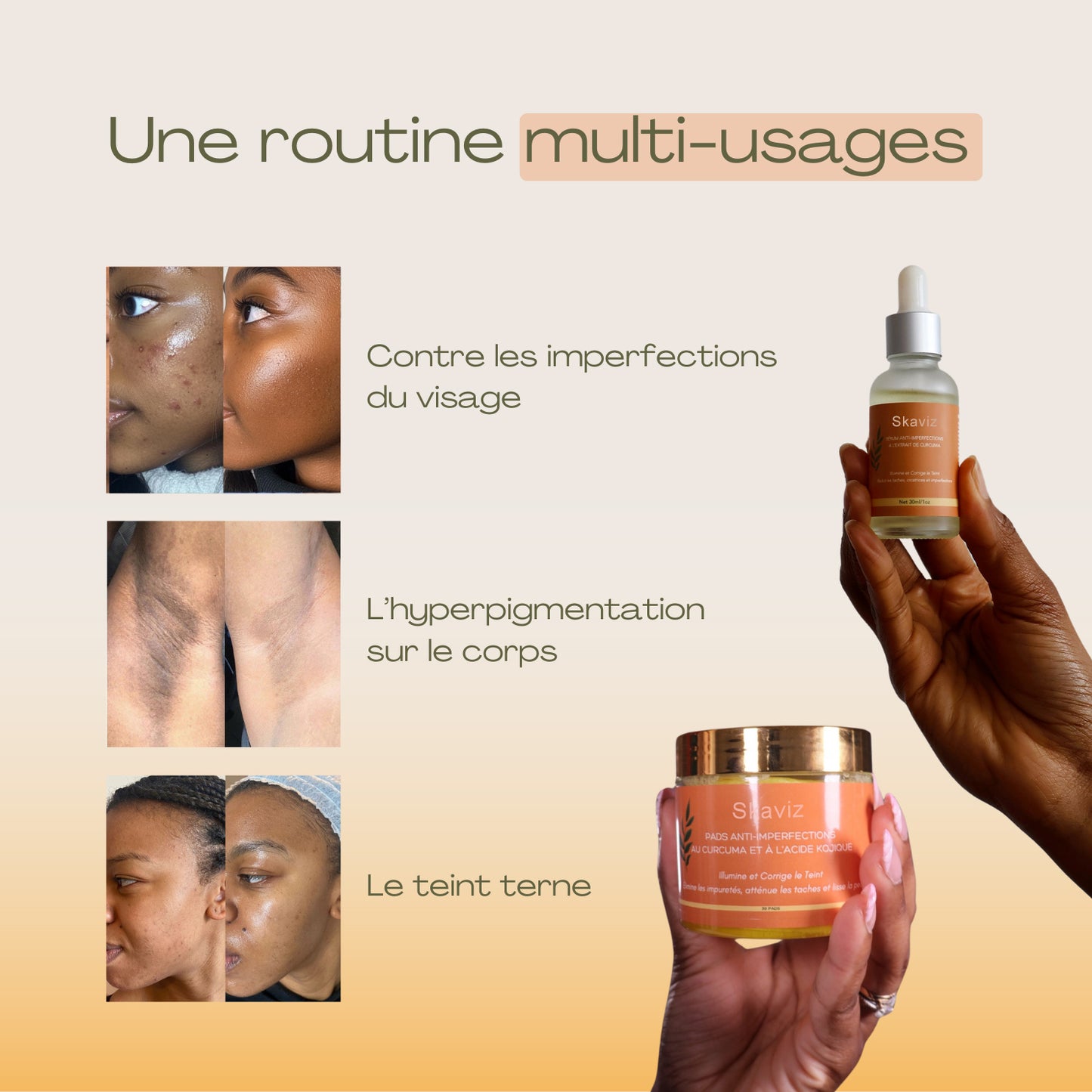 Routine de soin anti-imperfections 4-en-1 – Combat les boutons, les pores, les taches et la texture irrégulière