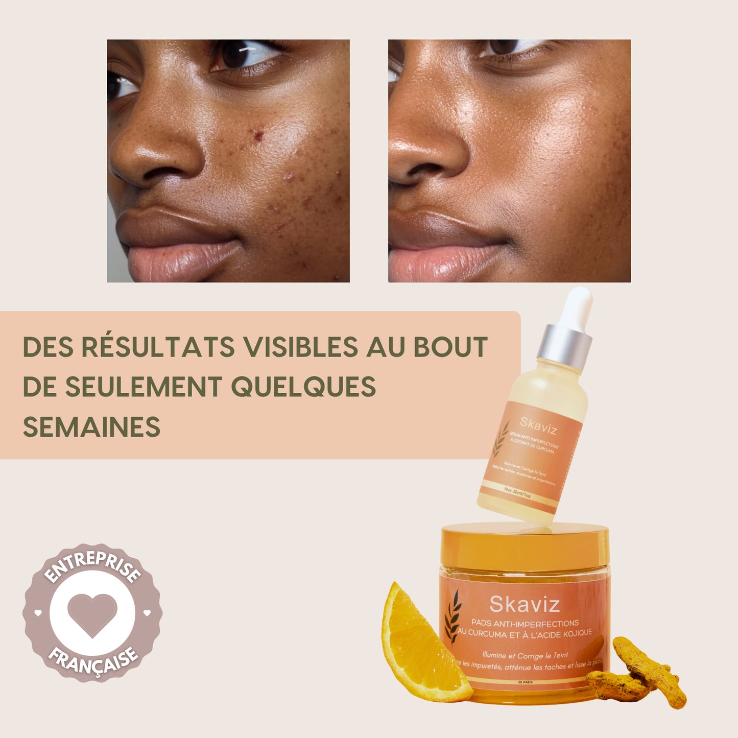 Routine de soin anti-imperfections 4-en-1 – Combat les boutons, les pores, les taches et la texture irrégulière