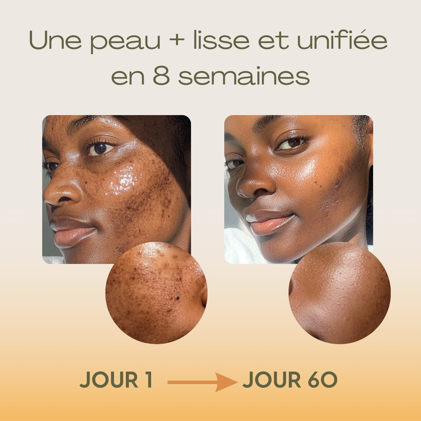 Routine de soin anti-imperfections 4-en-1 – Combat les boutons, les pores, les taches et la texture irrégulière