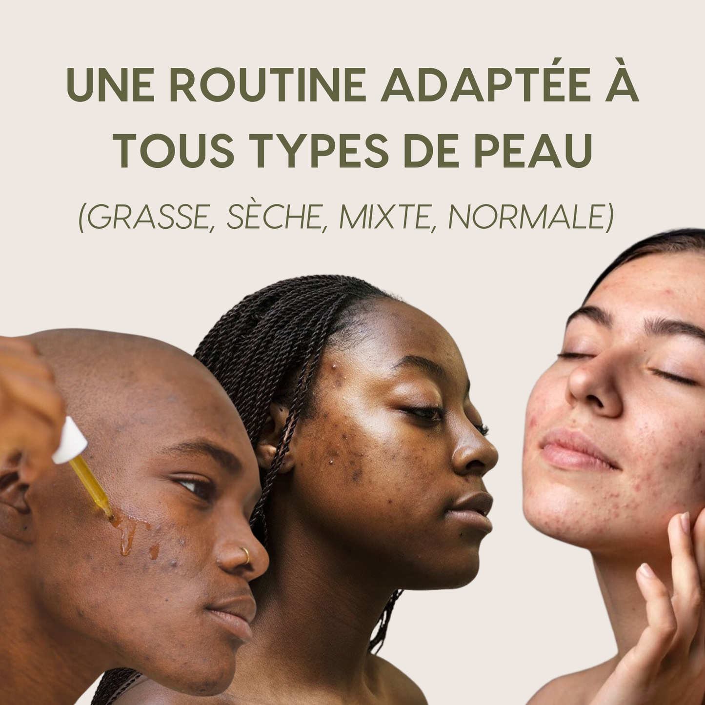 Routine de soin anti-imperfections 4-en-1 – Combat les boutons, les pores, les taches et la texture irrégulière