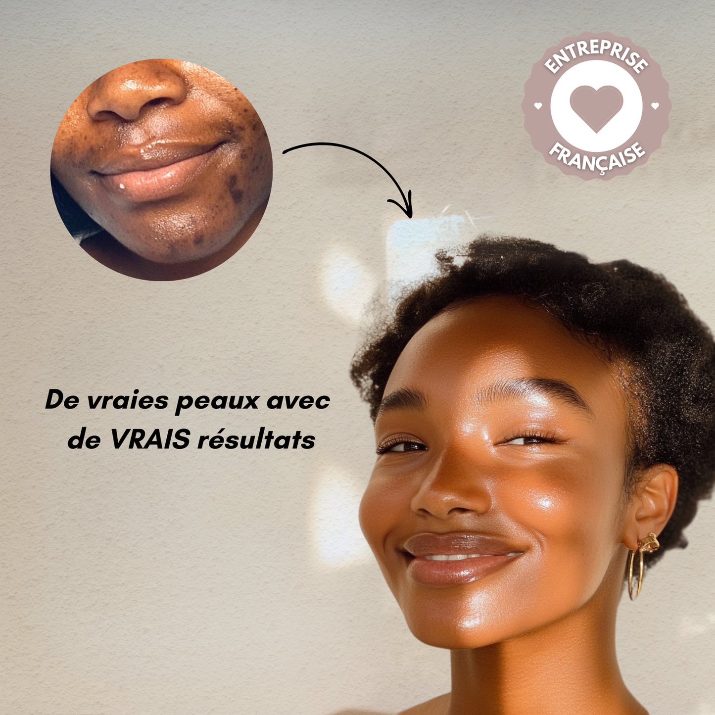 Routine de soin anti-imperfections 4-en-1 – Combat les boutons, les pores, les taches et la texture irrégulière