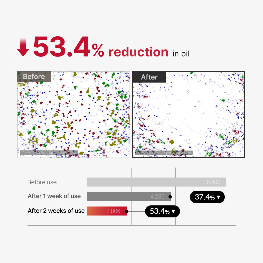 Red Body Peeling Shot β 32% Acid Power for Deep Skin Renewal