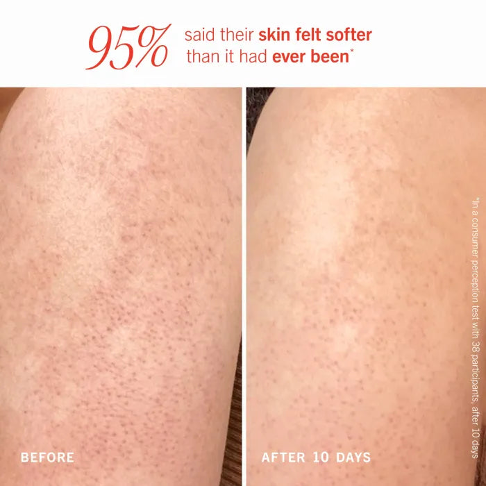Skaviz KP Bump Eraser Body Scrub – 10% AHA | Vegan | Fresh Peach Scent