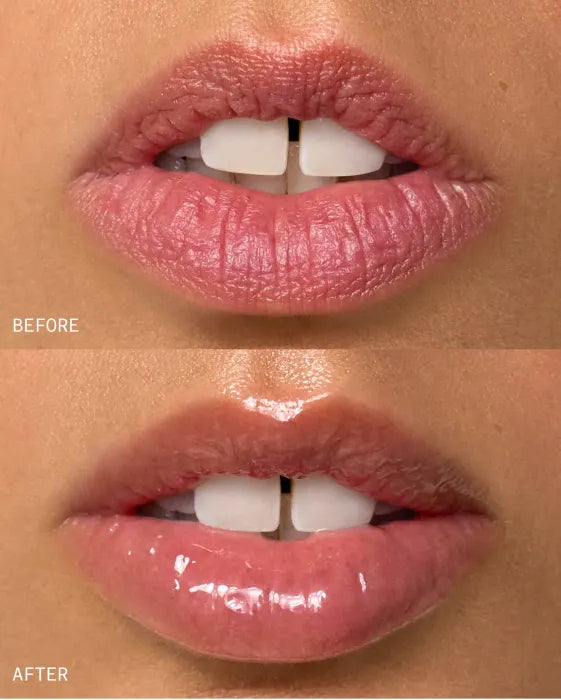 BBOJI™ Active Repair Balm – Not Just a Lip Balm