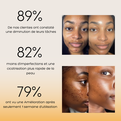 Routine de soin anti-imperfections 4-en-1 – Combat les boutons, les pores, les taches et la texture irrégulière